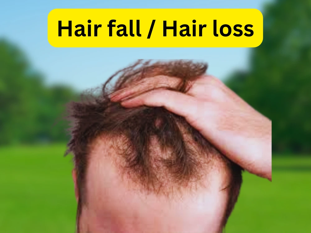 hairfall, hair loss, hair problems