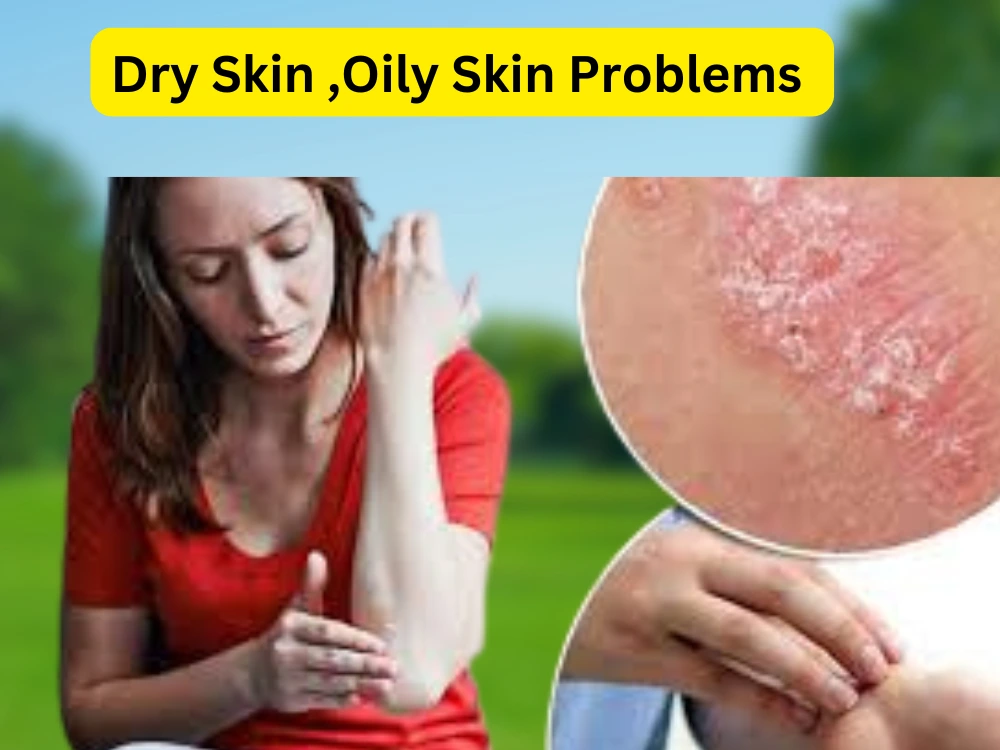 dry skin , oily skin , sensitive skin, skin problems